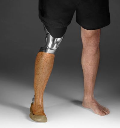bespoke prosthetic leg