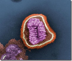 701px-Influenza_virus_particle_color
