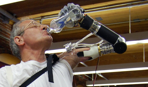 The 'Luke' bionic arm